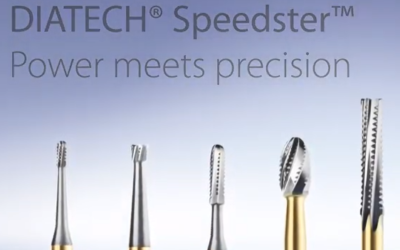 DIATECH Speedster – Power meets precision